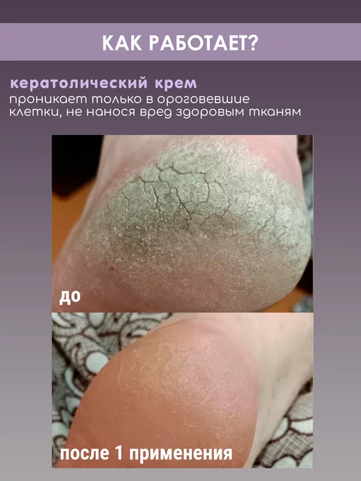 The VIRgin Beauty Кератолик для пяток от огрубевшей кожи и натоптышей, вариант, фото 2
