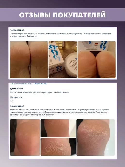 The VIRgin Beauty Кератолик для пяток от огрубевшей кожи и натоптышей, вариант, фото 4