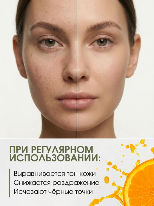 Green Era Гидрофильное масло для умывания лица, зеленый, фото 4