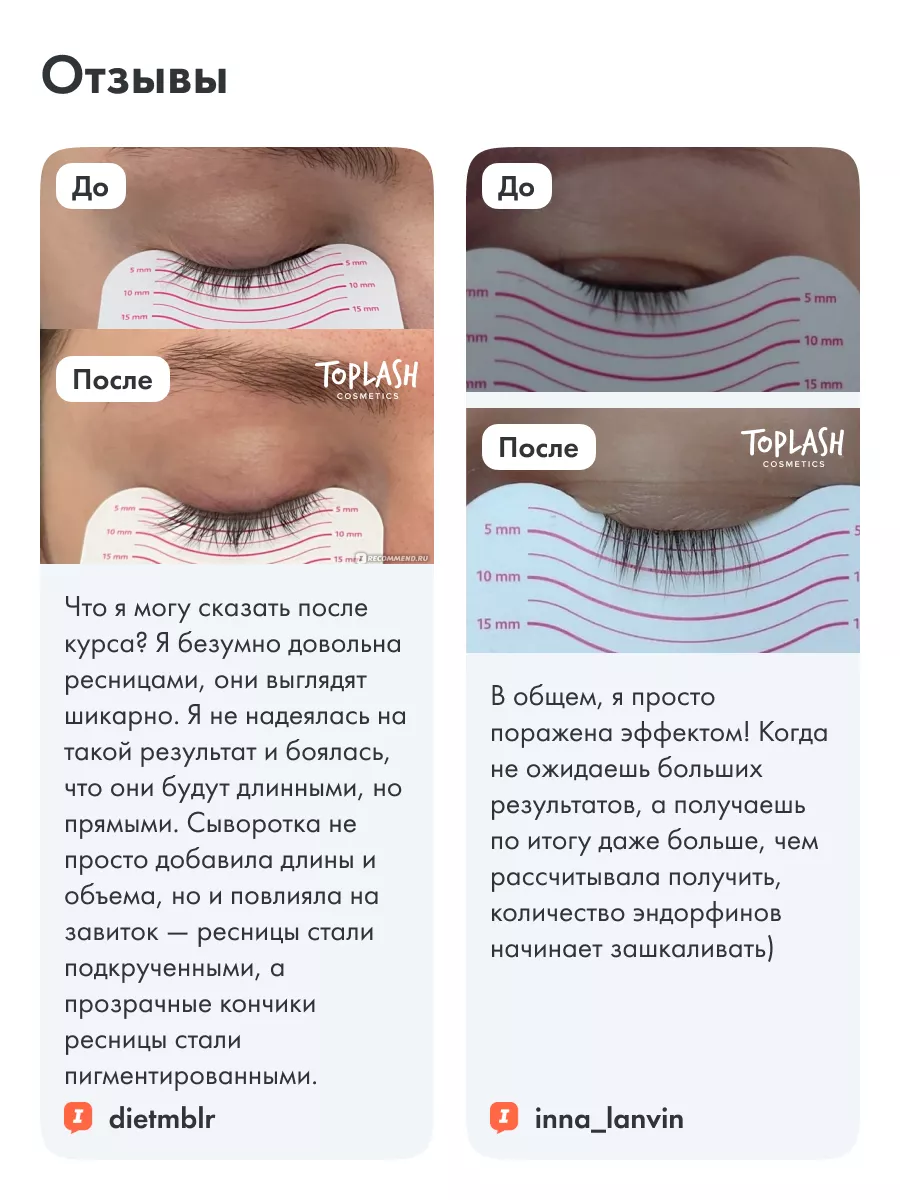 Топ леш