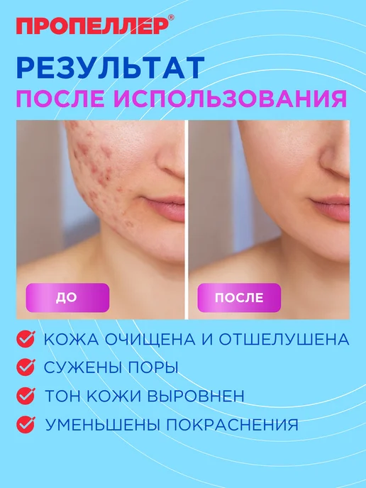 ПРОПЕЛЛЕР Салициловый лосьон для лица от прыщей для жирной кожи 100 мл, 100 мл, фото 4