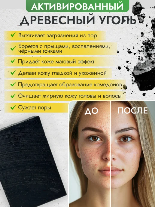 Море Мыла Угольное мыло для проблемной кожи лица и тела, вариант, фото 2