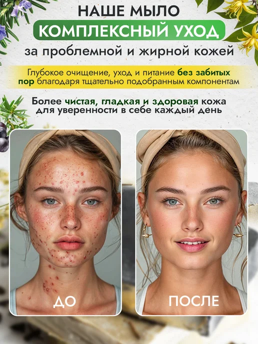 Море Мыла Угольное мыло для проблемной кожи лица и тела, вариант, фото 5