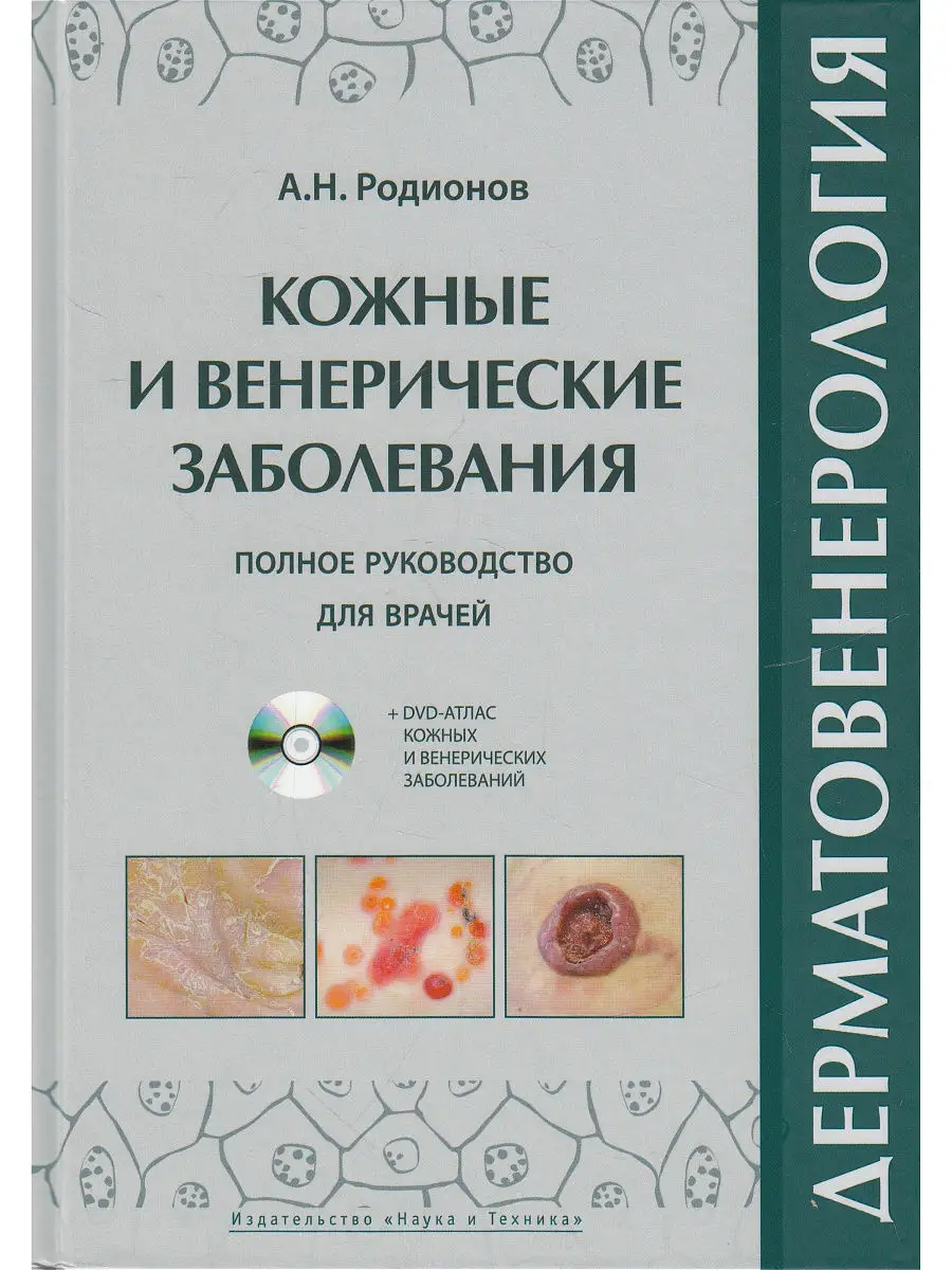 Дерматовенерология. Атлас кожных и венерических заболеваний. Издательство  Наука и техника 12272862 купить в интернет-магазине Wildberries