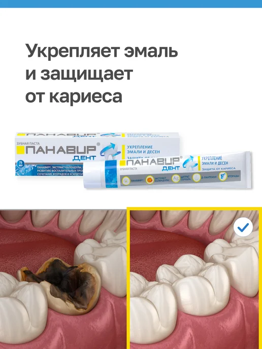 ПАНАВИР Дент профессиональная паста для укрепления эмали и десен, вариант, фото 2