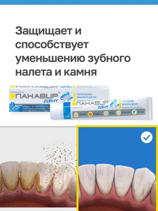 ПАНАВИР Дент профессиональная паста для укрепления эмали и десен, вариант, фото 3