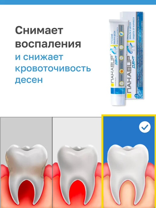 ПАНАВИР Дент профессиональная паста для укрепления эмали и десен, вариант, фото 4