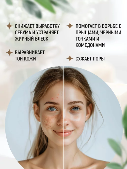 Elibest Мыло дегтярное натуральное для бани, умывания лица от прыщей, вариант, фото 3