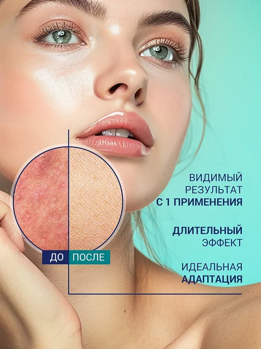 Эпидерил Лосьон для проблемной кожи от прыщей и акне 100мл, 100 мл, фото 2