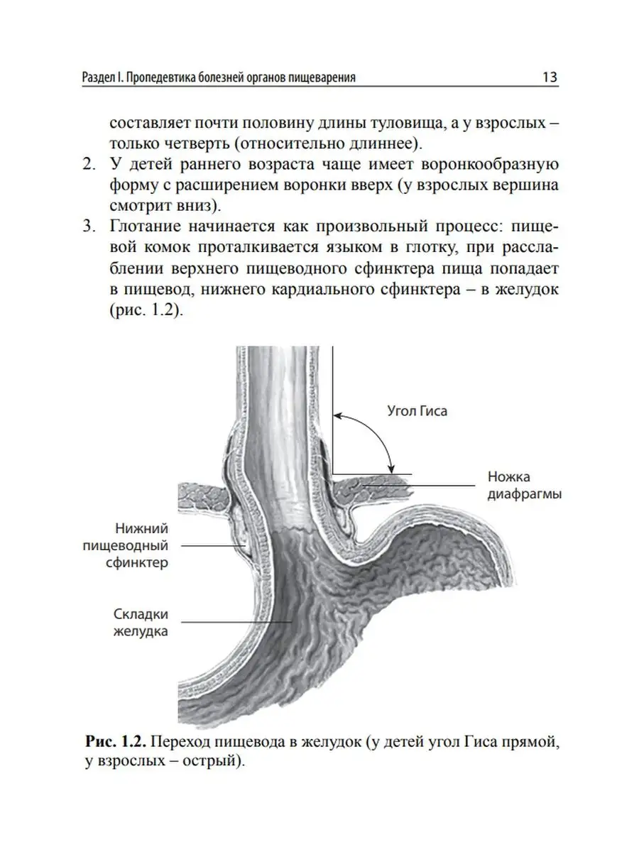 Hernia of the esophageal orifice of the diaphragm