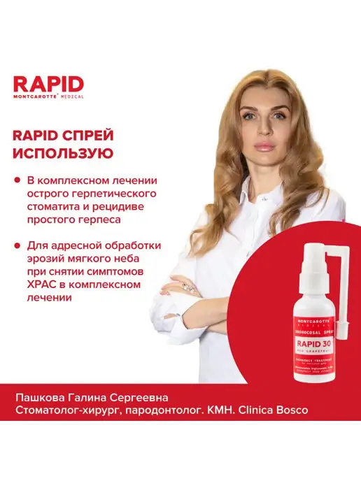 MONTCAROTTE Спрей для полости рта RAPID 30 с хлоргексидином, 30 мл, Итал…, 30 мл, фото 7