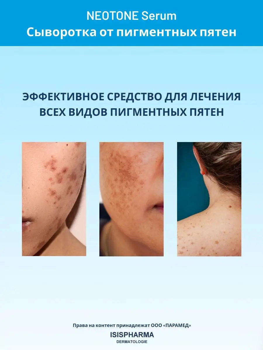 Сыворотка для лица от пигментных пятен Neotone Serum 30 мл ISISPHARMA  13673890 купить за 2 479 ₽ в интернет-магазине Wildberries