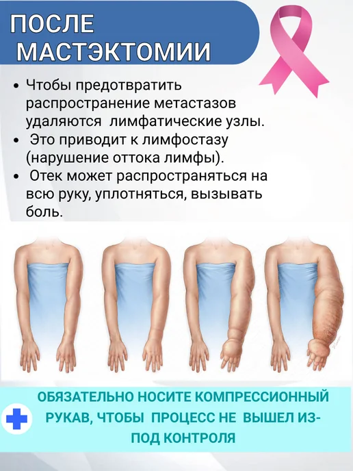 центр компресс Рукав компрессионный с перчаткой и пальцем, бежевый, фото 7