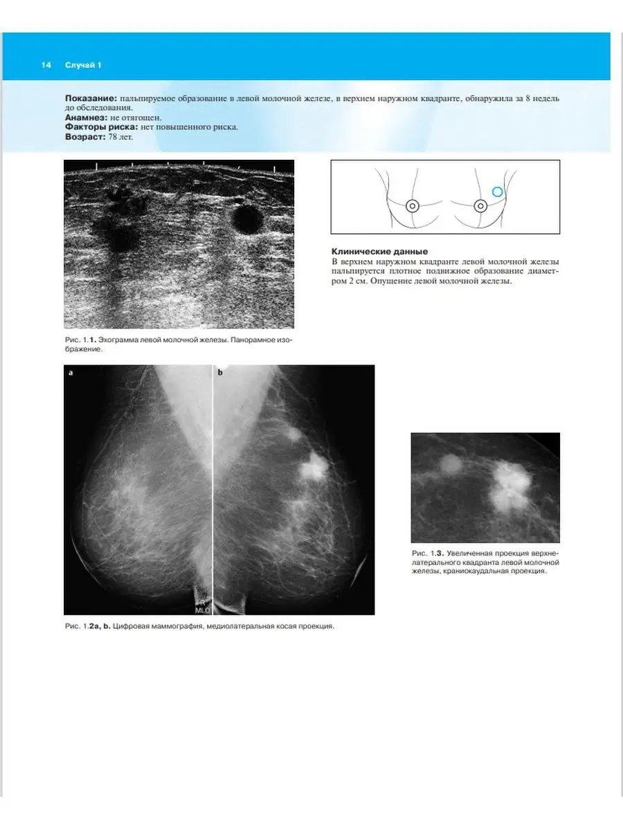 Маммография. 100 клинических случаев МЕДпресс-информ 13833430 купить в  интернет-магазине Wildberries