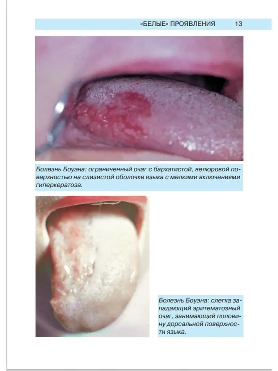 Заболевания слизистой оболочки рта и губ МЕДпресс-информ 13833435 купить в  интернет-магазине Wildberries