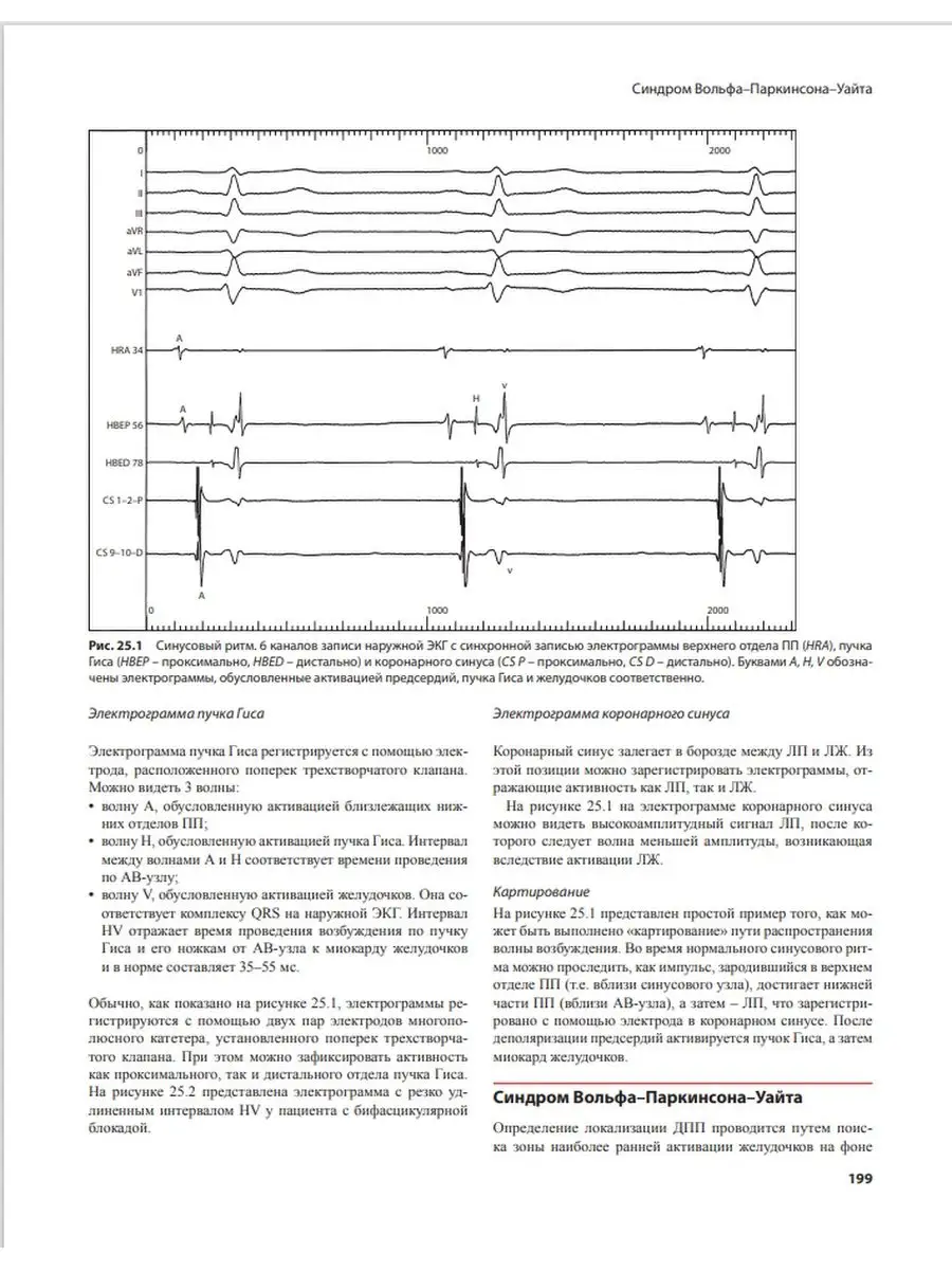 Аритмии сердца. Практические заметки по МЕДпресс-информ 13833469 купить в  интернет-магазине Wildberries