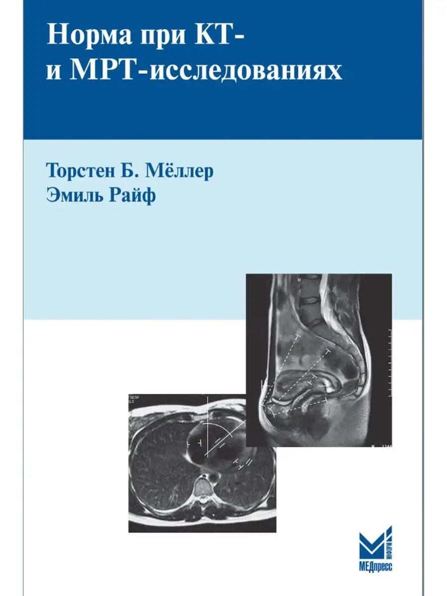 Норма при КТ- и МРТ-исследованиях МЕДпресс-информ 13833488 купить в  интернет-магазине Wildberries