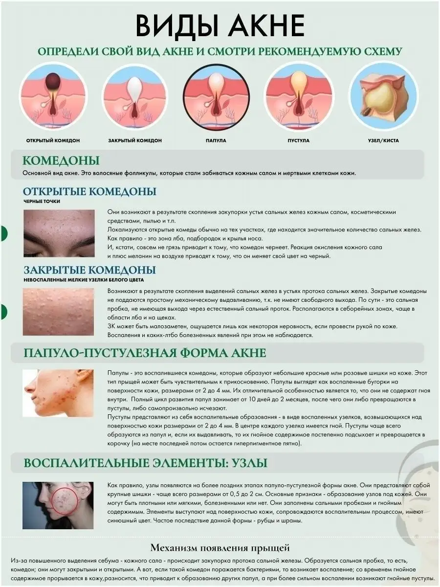 Маска пилинг от прыщей черных точек акне для подростков Vishell 13854178  купить за 842 ₽ в интернет-магазине Wildberries