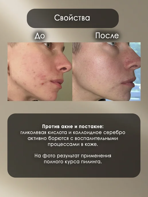 Novaline Cosmetics Пилинг гликолевый от воспалений и пигментации для лица, 50 мл, фото 2