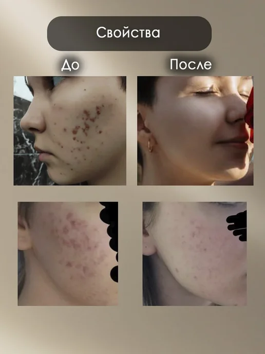 Novaline Cosmetics Пилинг гликолевый от воспалений и пигментации для лица, 50 мл, фото 3