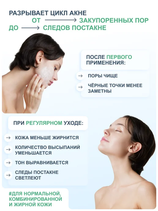 RICHE Гель для умывания лица энзимный с кислотами, вариант, фото 2