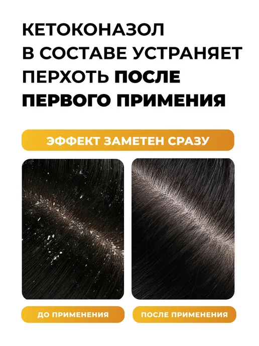 Лошадиная Сила Шампунь от перхоти лечебный с кетоконазолом 250мл, 250 мл, фото 3