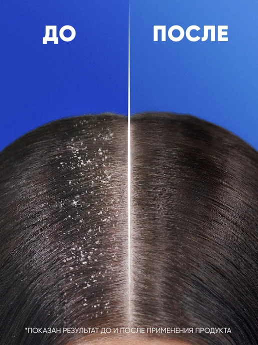 Head & Shoulders Шампунь для волос мужской Sport Fresh 360 мл, 360 мл, фото 5