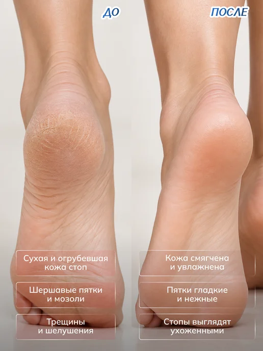 Petitfee Увлажняющая маска носочки для ног с мочевиной Корея 1 пара, белый, фото 2
