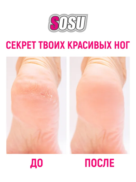 SOSU Пилинг носочки для педикюра отшелушивающие японские 1 пара, белый, фото 7