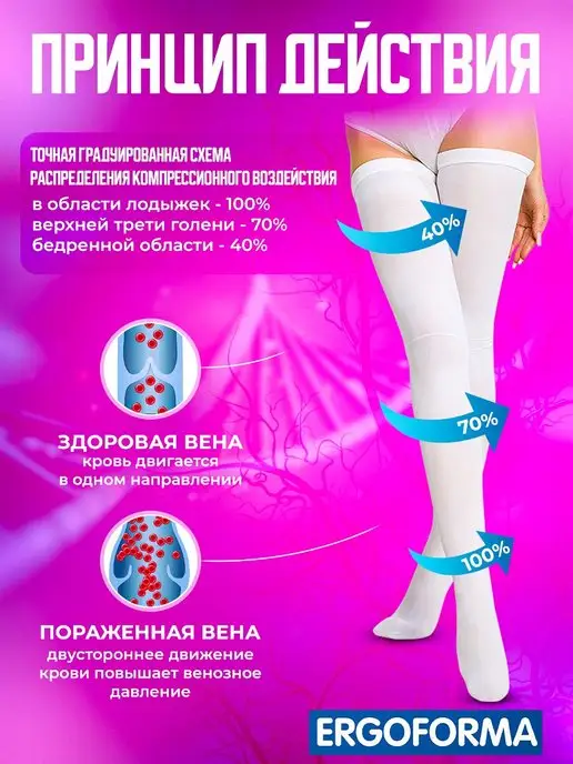 ERGOFORMA Компрессионные чулки 2 класс для операции, для родов белые, белый, фото 6