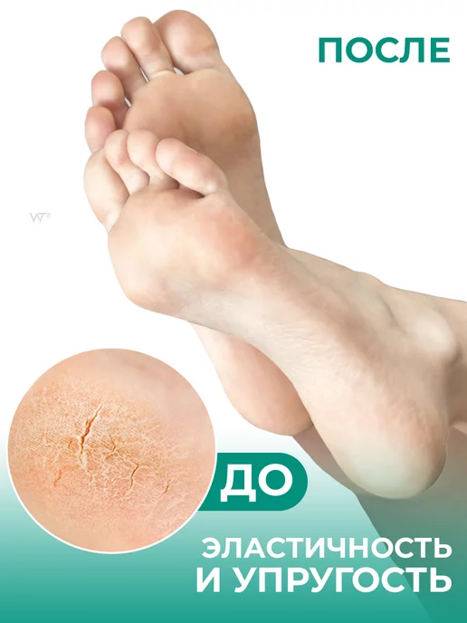 SKINLITE Носочки для педикюра пилинг маска для ног отшелушивающая, белый, фото 3