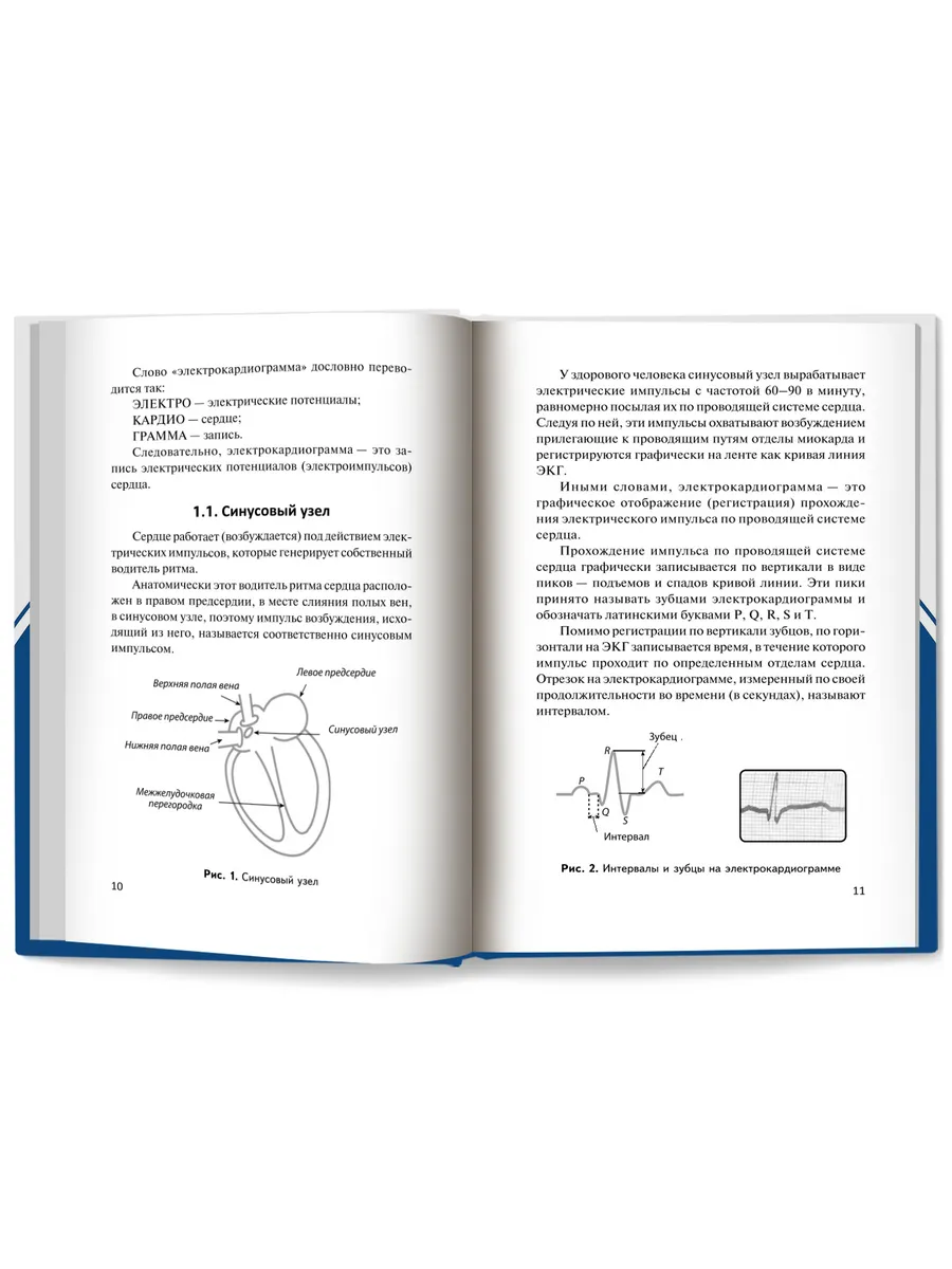 Азбука ЭКГ и боли в сердце Издательство Феникс 7177043 купить за 477 ₽ в  интернет-магазине Wildberries