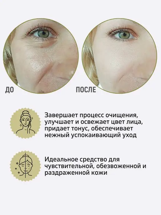 Белита Тоник Лосьон для лица с D-пантенолом Успокаивающий, вариант, фото 2