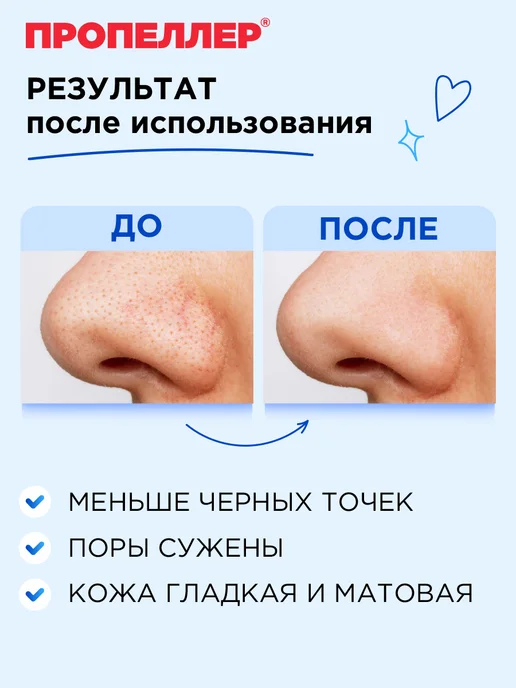 ПРОПЕЛЛЕР Очищающие полоски для носа, вариант, фото 4