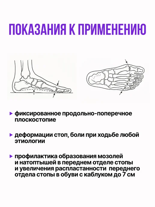 Trives Стельки ортопедические при плоскостопии для обуви на каблуке, бежевый, фото 2