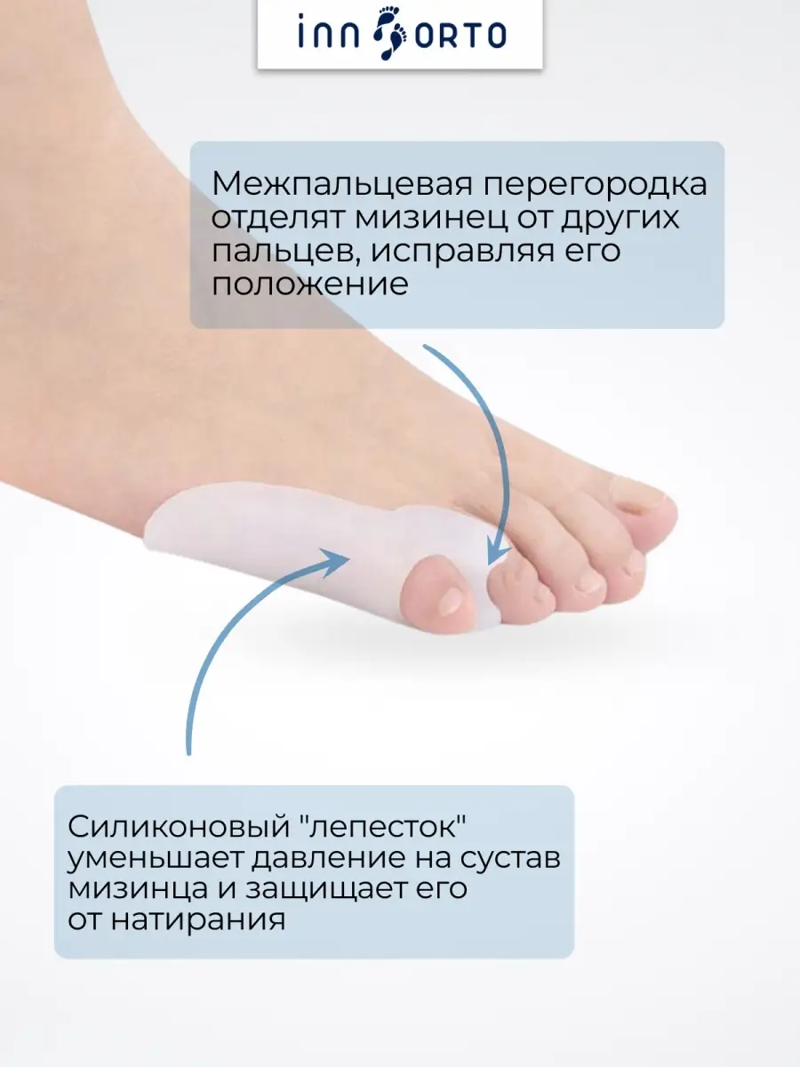 Перелом пальца ноги - Медичний центр 