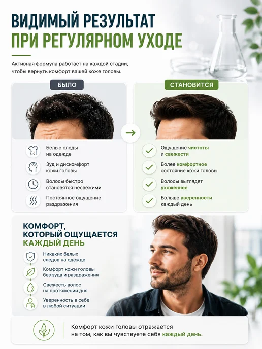 Selenta Шампунь от перхоти с Климбазолом 1.75%, 250 мл, фото 5